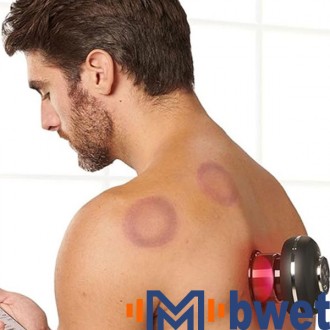 Portable Wireless Smart Cupping Massager, Heat Therapy & Suction, Relieve Fascia Tension & Improve Circulation 6-Gear Adjustable 